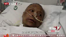 武汉市中心医院两位大夫抢救过来竟成“黑人”！可见同病毒斗争有多惨烈