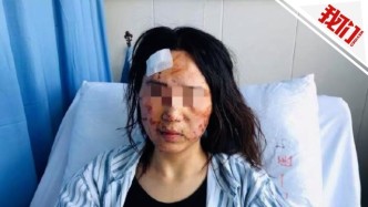 温州一女子因情感纠纷被丈夫和公公侮辱围殴 警方：已立案侦查