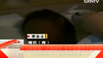 云南：飞来横祸！上班途中 女子突遭男子泼硫酸毁容