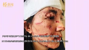 愤怒！温州女子当街被公公丈夫暴打毁容涂排泄物